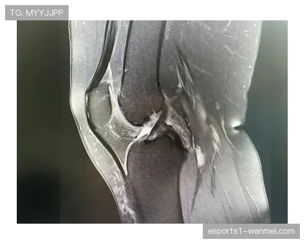 切尔西后卫科尔威尔参与合练 前十字韧带康复进入最后阶段